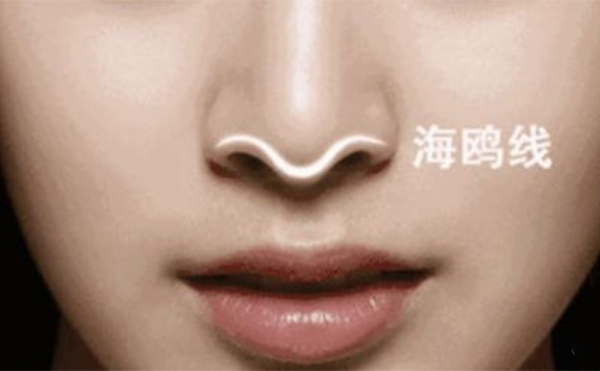 僅僅是對(duì)假體的形狀不滿意可以直接把原來的假體修好再放進(jìn)去嗎?