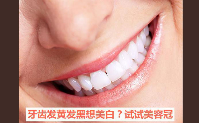 牙齒美容冠大約多少錢(qián)？牙齒美容冠怎么做的？