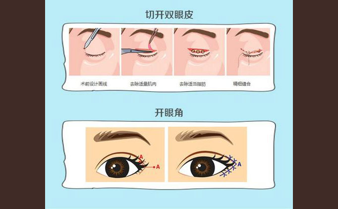 眼部修復(fù)手術(shù)包括什么項(xiàng)目？