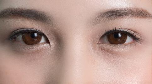 上眼皮松弛是什么原因引起的？