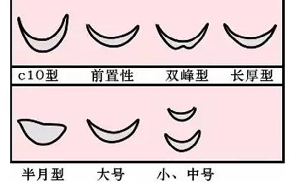墊下巴整形多少錢?墊下巴手術(shù)的價(jià)格受什么因素影響?