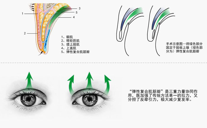 上瞼下垂的癥狀有哪些？