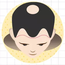 四級脫發(fā)