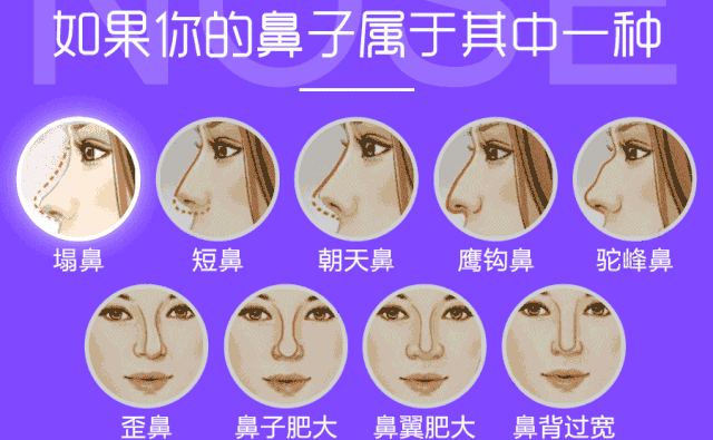 自體脂肪隆鼻可以保持多久？