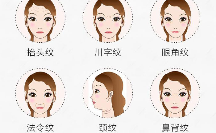 botox除皺針有哪些副作用？