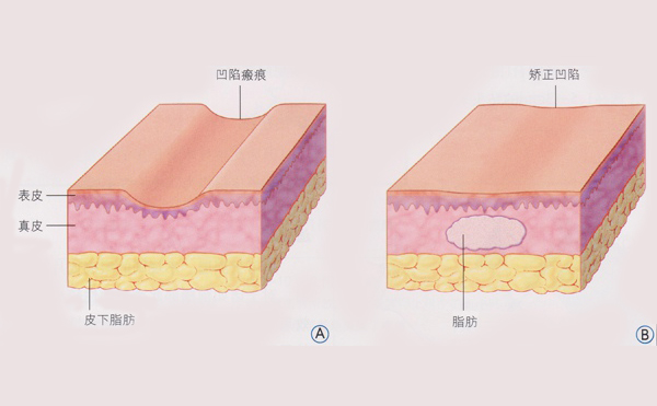 http://www.tengfangwang.cn/news/377.html