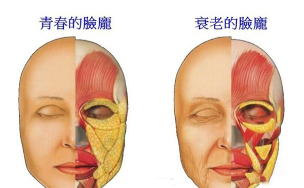電波拉皮的誤區(qū)？