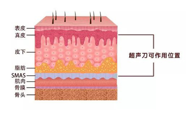 超聲刀有什么副作用?后果嚴重嗎?