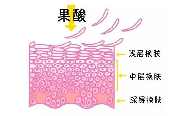 果酸煥膚的作用有哪些？