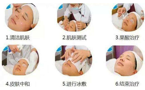 果酸煥膚的過程是什么？
