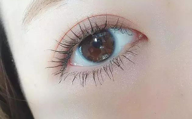 激光雙眼皮手術(shù)多少錢？激光雙眼皮手術(shù)需要多久恢復(fù)時(shí)間？