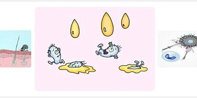 溶解酶術后