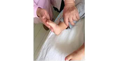 腳跟不著地矯正術后