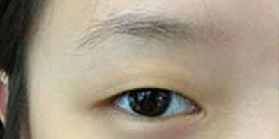 半永久紋眉術前