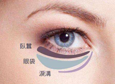 眼袋失敗修復(fù)要怎么處理？切眼袋需要多長時間恢復(fù)？