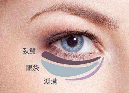 眼袋失敗修復(fù)要怎么處理？切眼袋需要多長時(shí)間恢復(fù)？