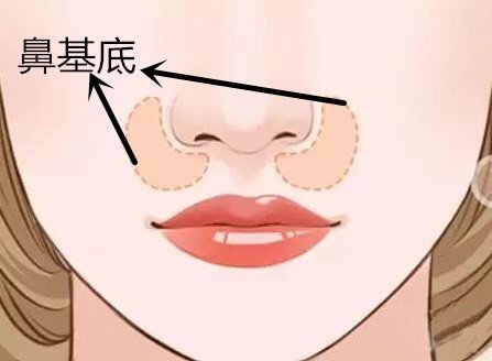 做玻尿酸墊鼻基底風(fēng)險(xiǎn)有哪些？深圳市玻尿酸豐鼻基底大概需要費(fèi)用？