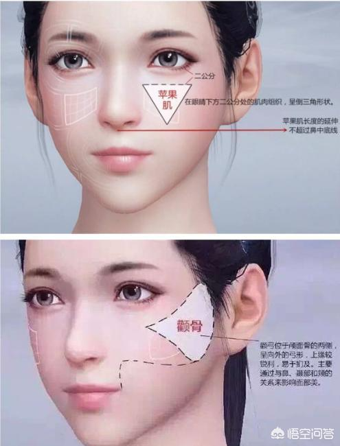 玻尿酸填充蘋(píng)果肌后效果能保持多久？想豐蘋(píng)果肌是自體好一點(diǎn)還是玻尿酸好一點(diǎn)？