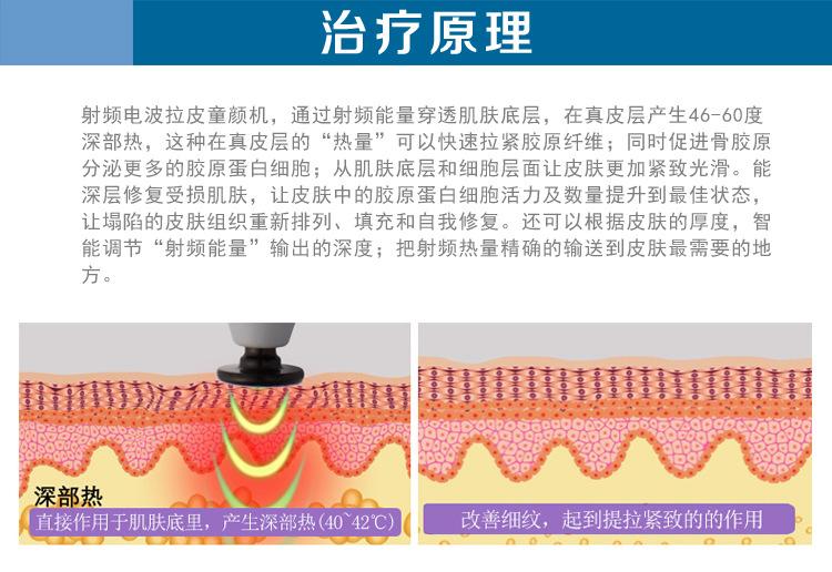  射頻緊膚的效果到底怎么樣呢？射頻緊膚多久做一次？