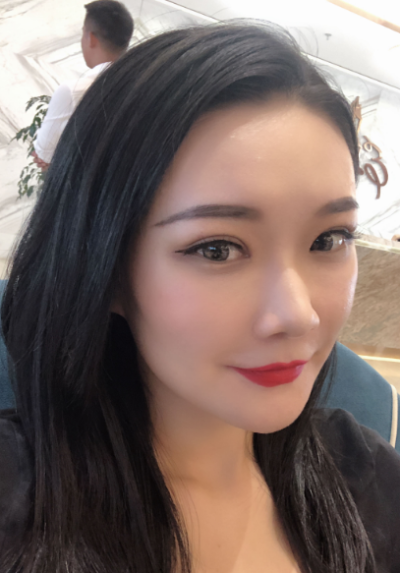  寧波尚美整形美容醫(yī)院做雙眼皮手術(shù)后的效果
