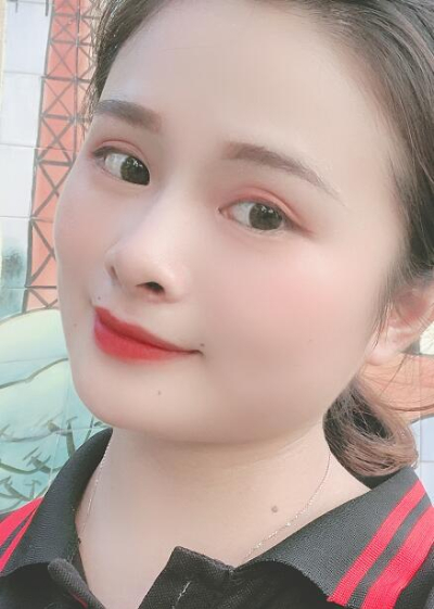 長(zhǎng)春中妍醫(yī)療美容醫(yī)院趙勝友雙眼皮案例效果分享