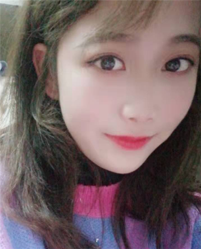 蘇州美貝爾美容醫(yī)院做面部吸脂手術后的效果