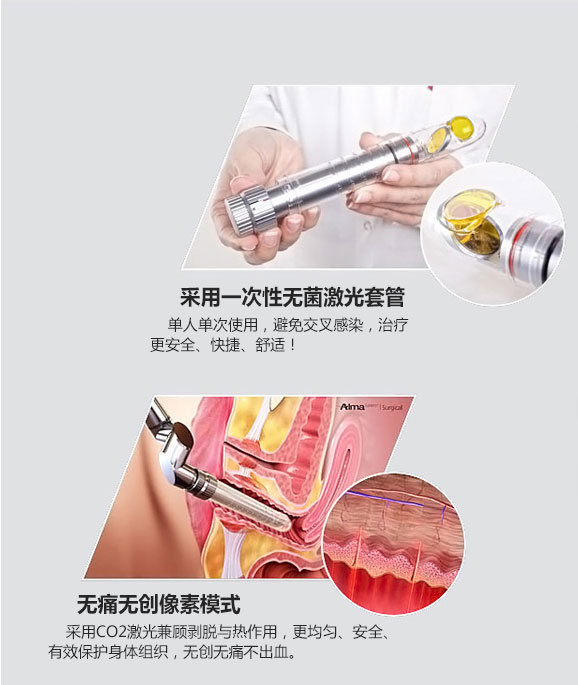 成都愛爾麗整形激光緊縮陰道怎么樣？激光緊縮陰道注意什么？
