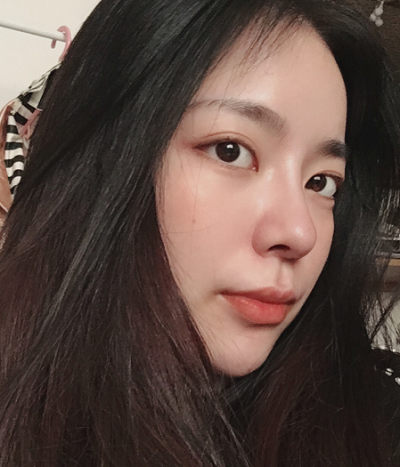 成都漢密爾頓美容醫(yī)院做鼻修復術(shù)后的日常情況