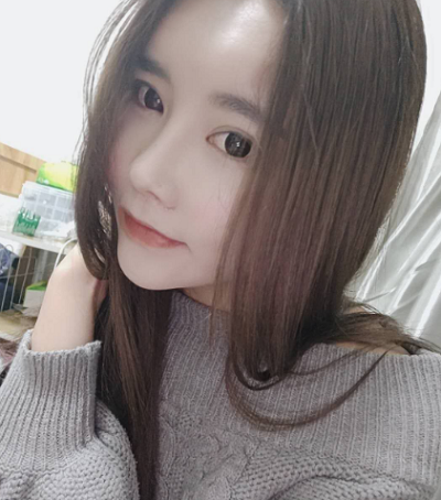 上海藝星醫(yī)療美容醫(yī)院做顴骨降低手術后的最終狀態(tài)