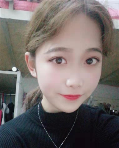 蘇州美貝爾美容醫(yī)院做面部吸脂術后的最終效果