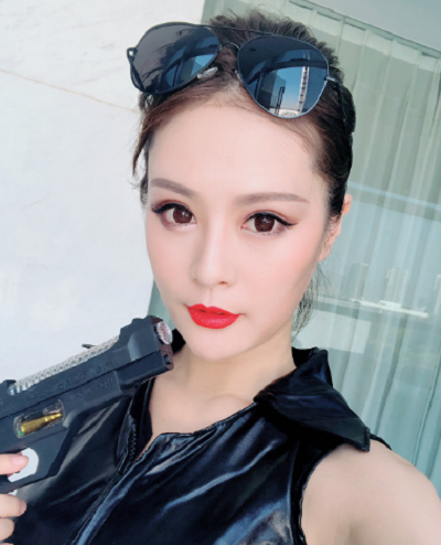 寧波尚美整形美容醫(yī)院齊強鼻綜合案例效果分享