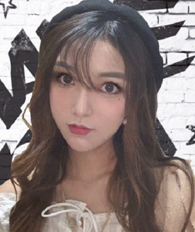 寧波尚美整形美容醫(yī)院齊強隆鼻案例效果分享