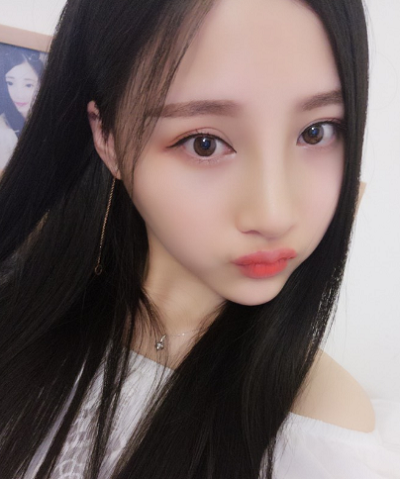 鄭州麗天整形美容醫(yī)院做面部吸脂手術后的最終狀態(tài)