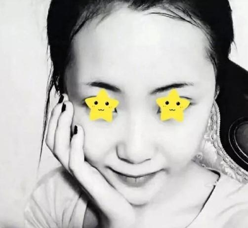 做綜合鼻，上海首爾麗格安建榮鼻綜合真人案例照片