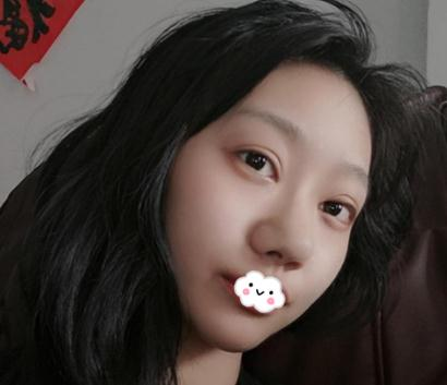 上海伊美爾港華做的3w的鼻子，你們說值不值