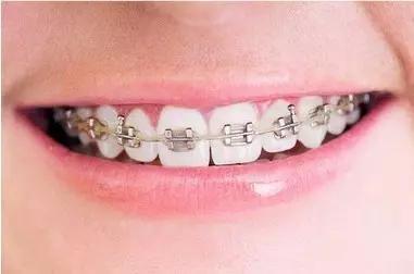 常州瀚景口腔牙齒拋光怎么樣？牙齒拋光有什么作用？