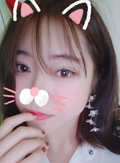 北京東方瑞麗醫(yī)療美容門診部做雙眼皮手術(shù)后的最終效果