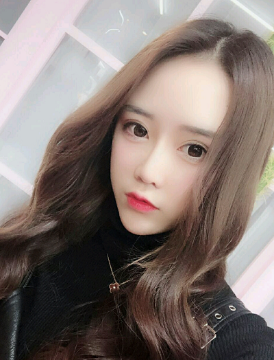 上海伊美爾港華醫(yī)療美容醫(yī)院做自體肋軟骨隆鼻手術后的最終效果