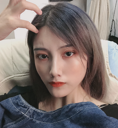 上海港華醫(yī)療美容醫(yī)院做隆鼻的恢復(fù)情況